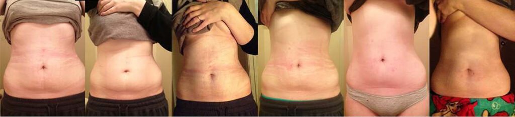 waist trainer corset results